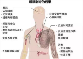 你的年龄该睡多长时间？晚上睡多久能算健康，睡多久可以看出自身疾病